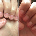 Nagelnährölstift