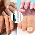 Premium 3-teiliges Eagle Beak Nagelknipser-Set