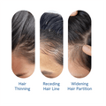 Fortschrittliches Roll-On-Serum für das Haarwachstum